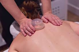 cupping in Southeast Texas, who offers cupping Beaumont TX, cupping therapy Golden Triangle, is cupping available in Lumberton TX?